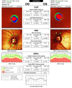 Optic Nerve Imaging