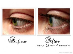 248dfed0-7453-417b-b73c-feb01ac3536cwallpaper Laser Eye Surgery in Toronto