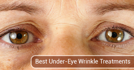 Best Under-Eye Wrinkle Treatments Best Under-Eye Wrinkle Treatments